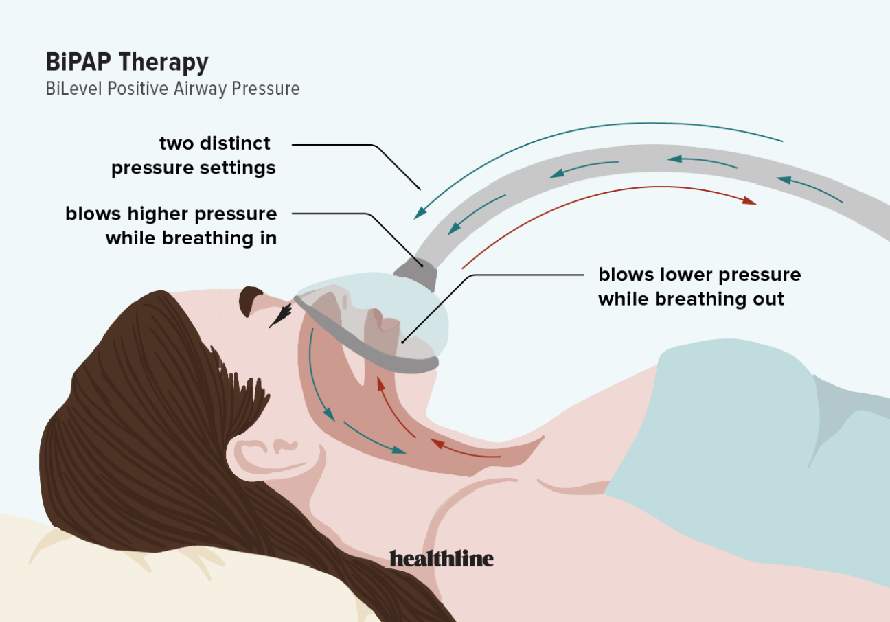 bipap-therapy