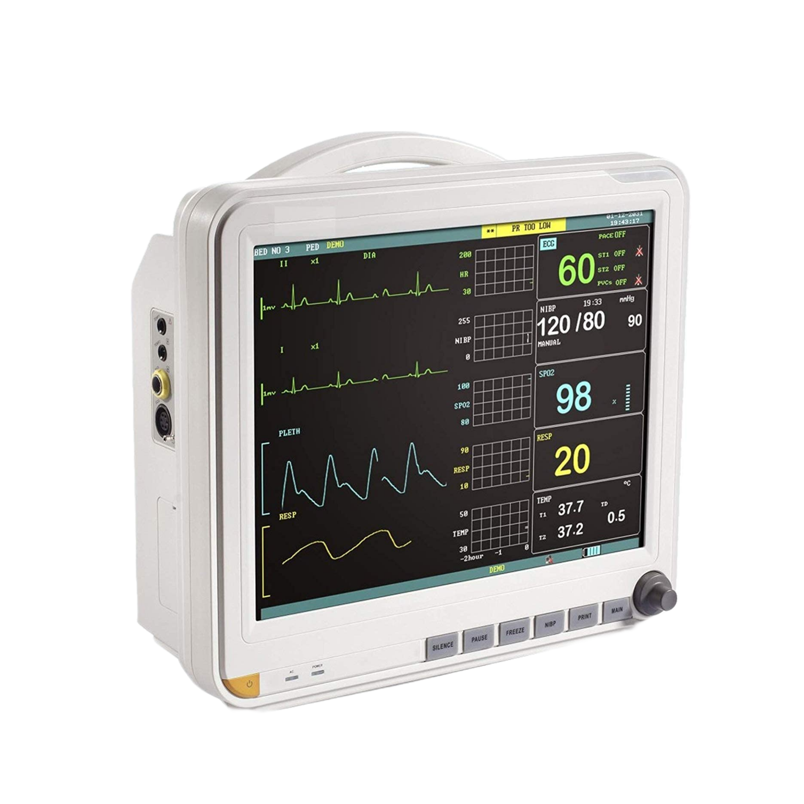 multipara monitor